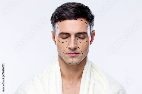 Man with closed eyes and marked with lines for plastic surgery