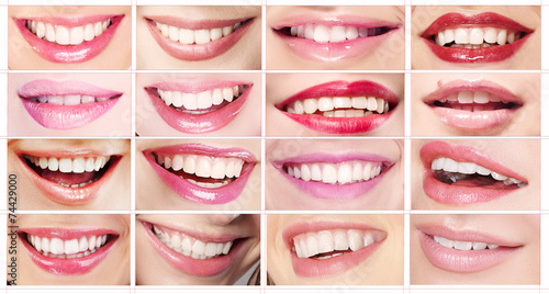 Lipsticks. Set of Women s Lips. Toothy Smiles