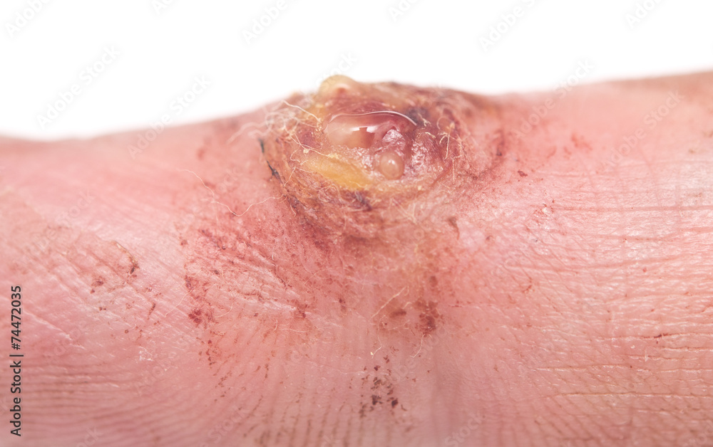 Fototapeta premium wart