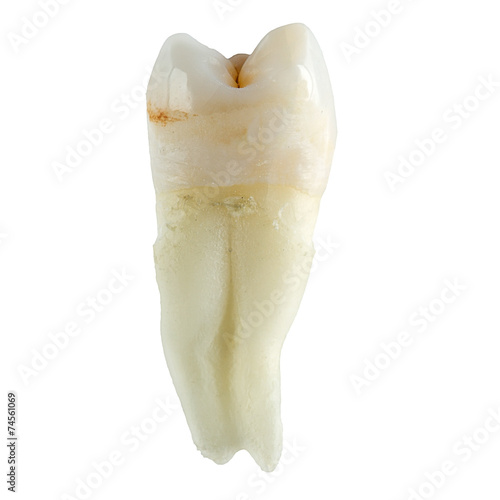 Extracted wisdom tooth on white background