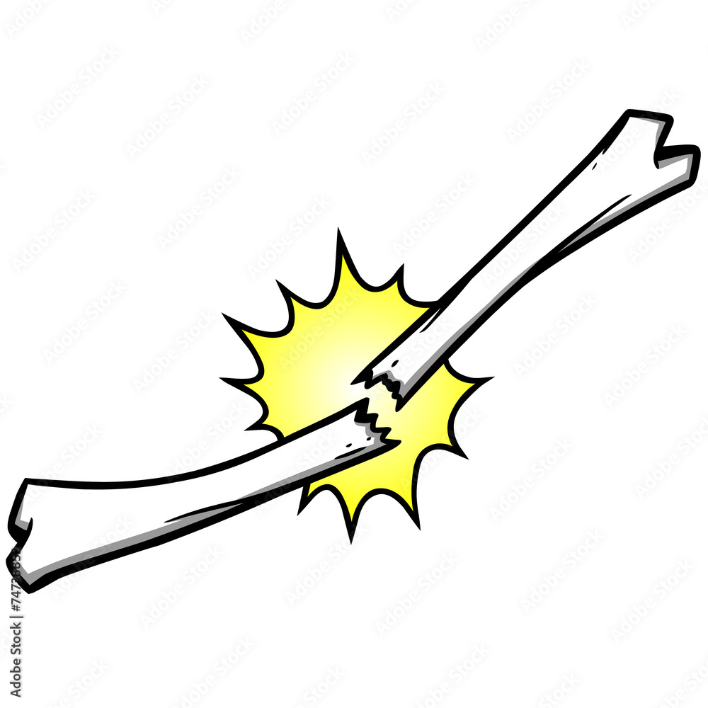 Broken Bone Broken Bone