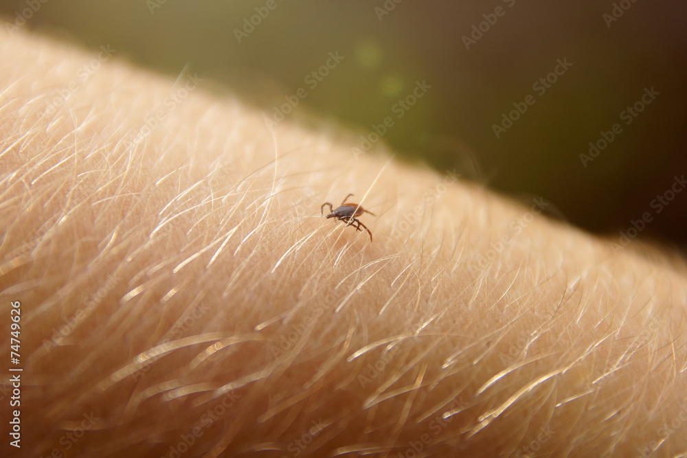Tick crawles on skin Tick crawles on skin