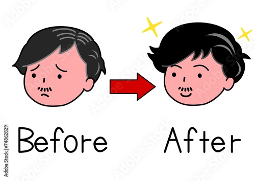 髪が減った男性とふさふさの男性