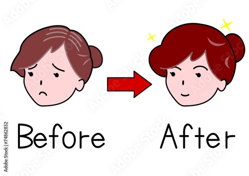 髪が減った女性とふさふさの女性