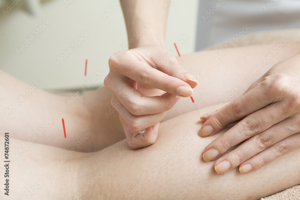 Fototapeta premium Calf of acupuncture