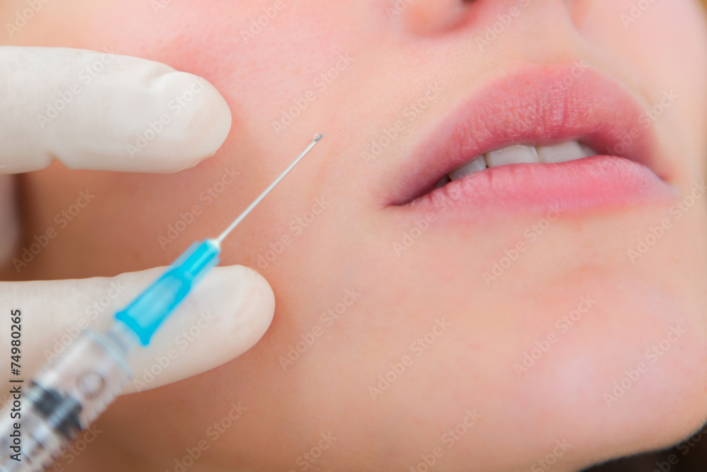 Close up view of a lip injection