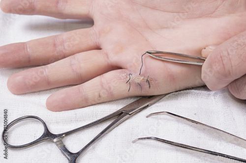 Close up of removing medical thread from wound