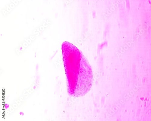 Opalina ranarum - permanent slide plate under high magnification photo