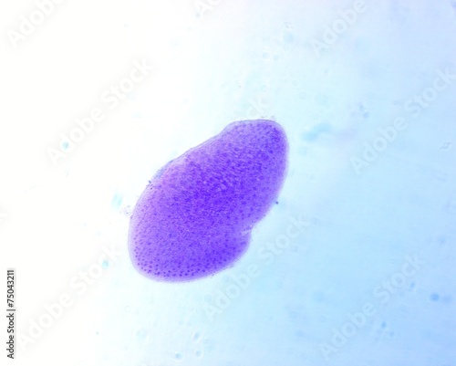 Opalina ranarum - permanent slide plate under high magnification photo