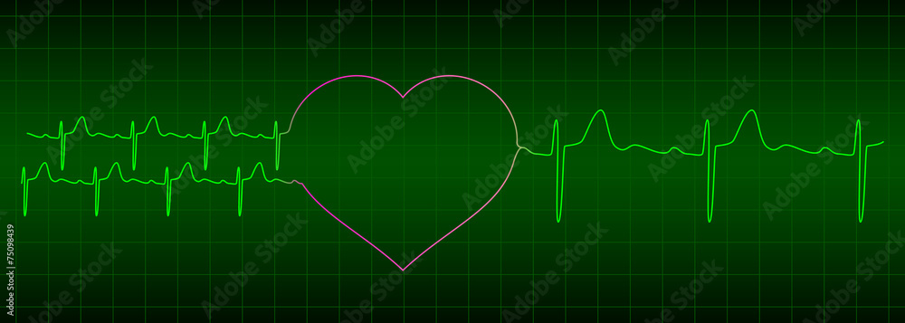 two ekg signals from two hearts after love is one heartbeat two ekg signals from two hearts after love is one heartbeat