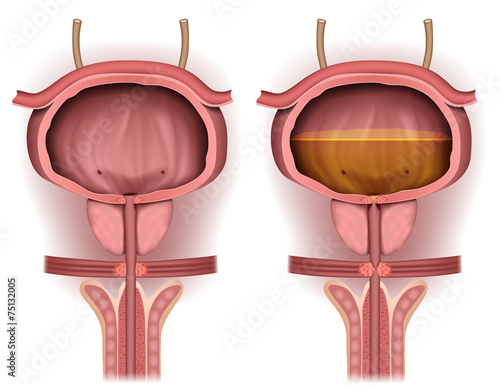 Harnblase, gefüllt und leer, anatomie