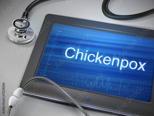 chickenpox word display on tablet