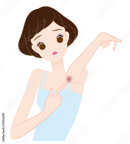 ひじの黒ずみを気にする女の子