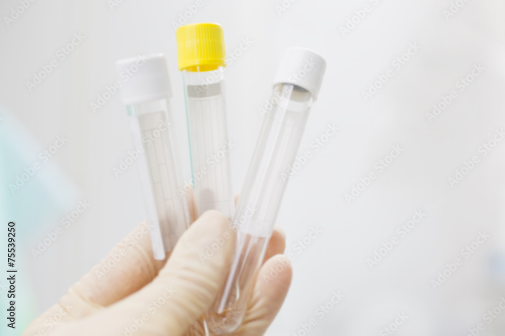 Blood testing tubes equipment Blood testing tubes equipment