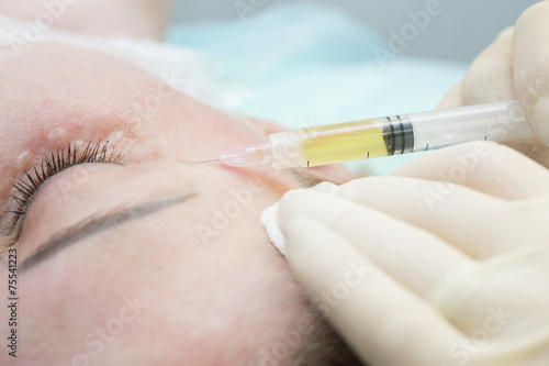 Beautician procedure Plasmolifting injection photo