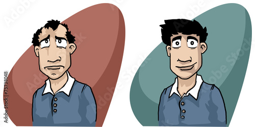 hair loss concept, man before and after treatment