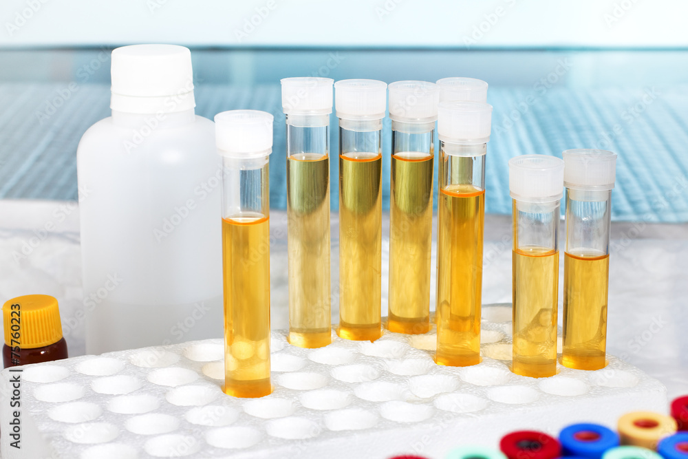 analysis of urine in lab analysis of urine in lab