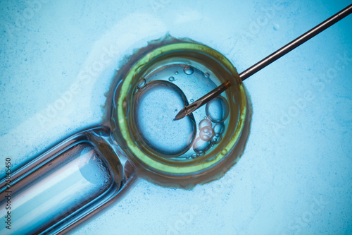 In vitro fertilisation, IVF macro concept photo