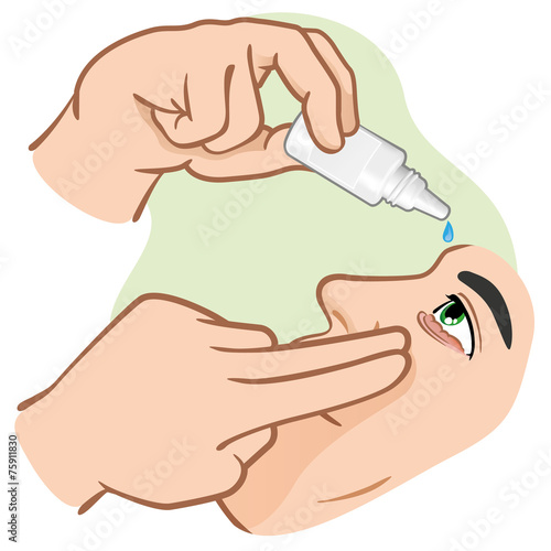 Medication eye drops to drip in irritated eyes.