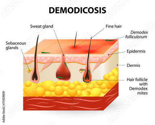 demodicosis. Demodex mite