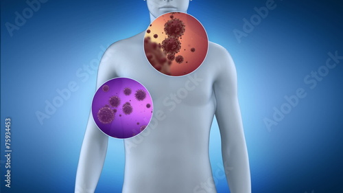 Various bacteria attacking on human body
