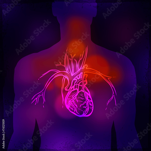 Human Heart X-ray