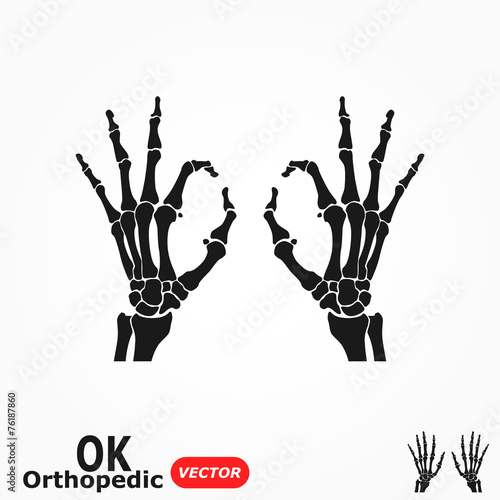 OK orthopedic  ( X-ray human hand with OK sign )