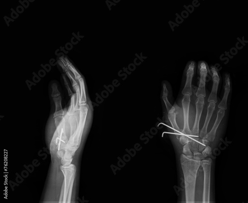 Foto hand with wire