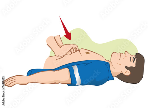 First Aid resuscitation (CPR), abdominal compression massage