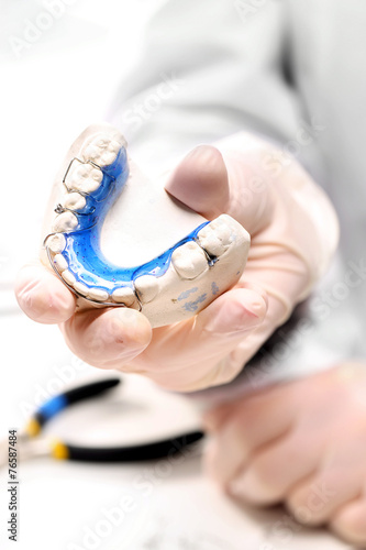 Aparat ortodontyczny, odlew gipsowy, aparat ruchomy