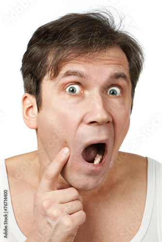Canvas Print Men squeezing a pimple
