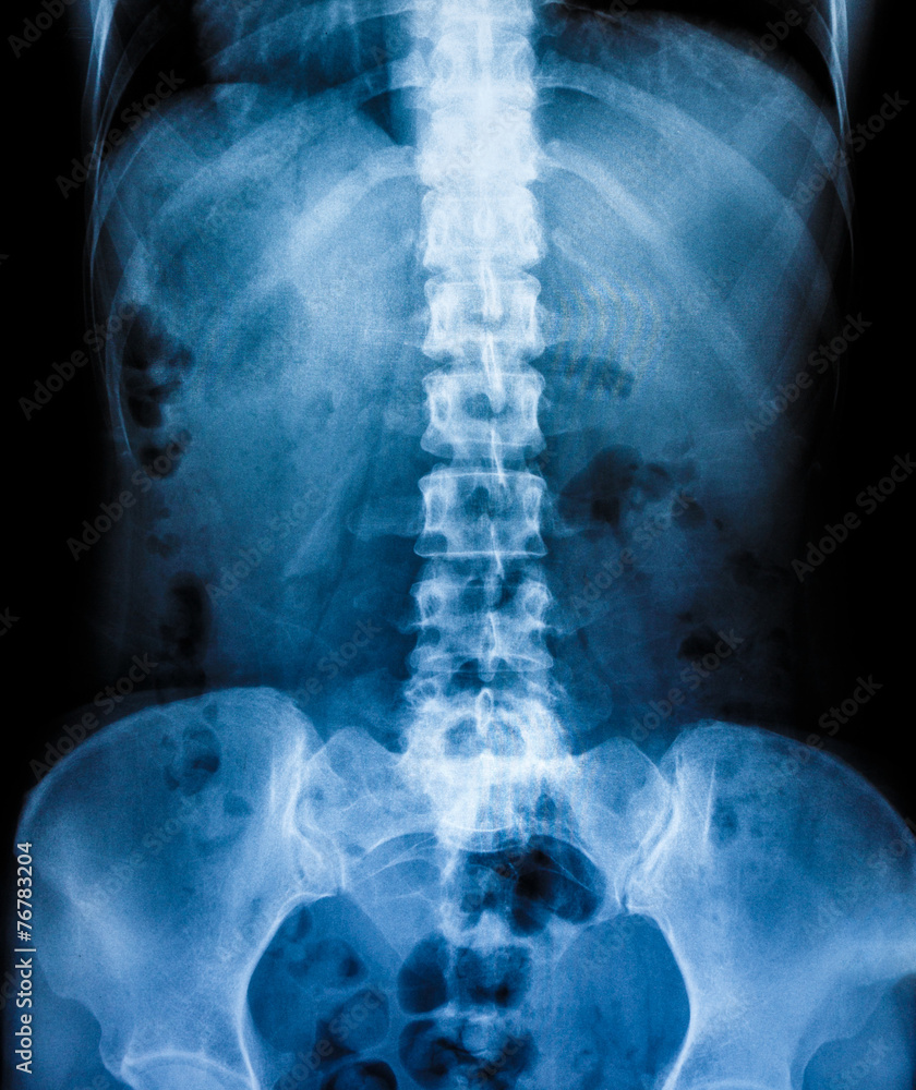 X-Ray scan human