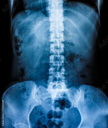 Obraz na płótnie X-Ray scan human w salonie