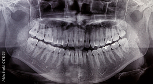 Obraz na płótnie X-Ray scan human for teeth w salonie