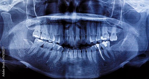 Obraz na płótnie X-Ray scan human for teeth w salonie