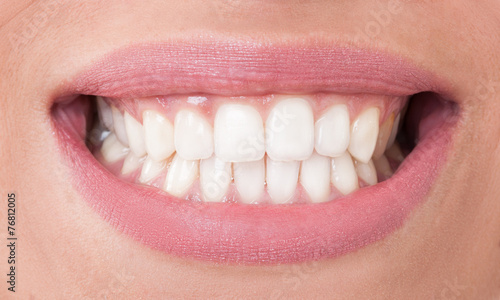 Canvas Print Closeup with perfect female teeth