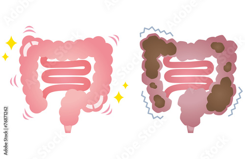 健康な大腸　便秘の大腸 photo