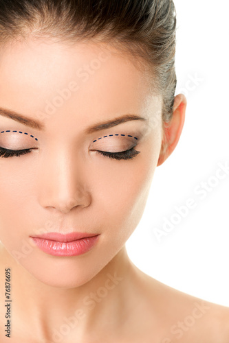 Eyelids plastic surgery concept - asian monolids
