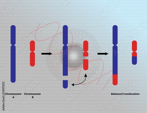 Chromosomal translocation photo