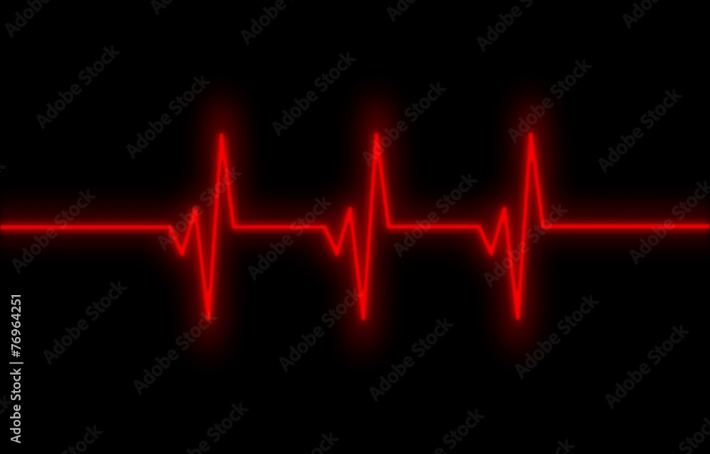 Electrocardiogram - Concept of healthcare Electrocardiogram - Concept of healthcare