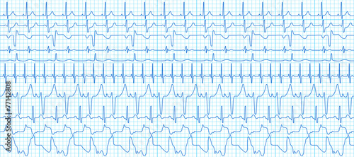 Cardiograms