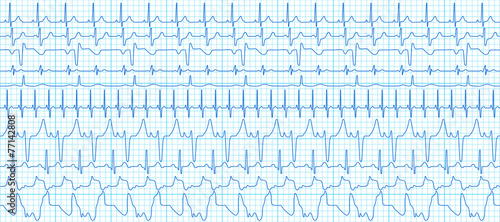 Cardiograms