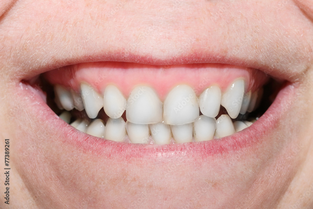 Fototapeta premium Close up a big mouth showing a teeth.