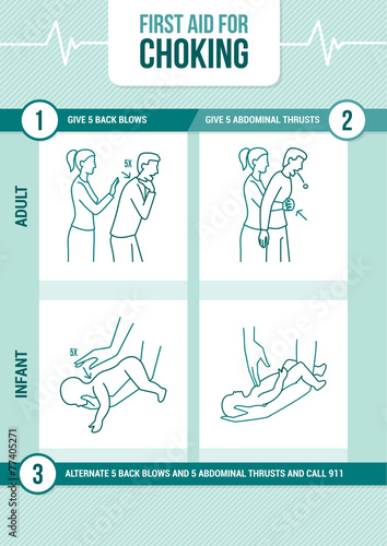 First aid for choking photo