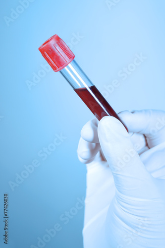 Hand holding blood in test tube take with blue filter