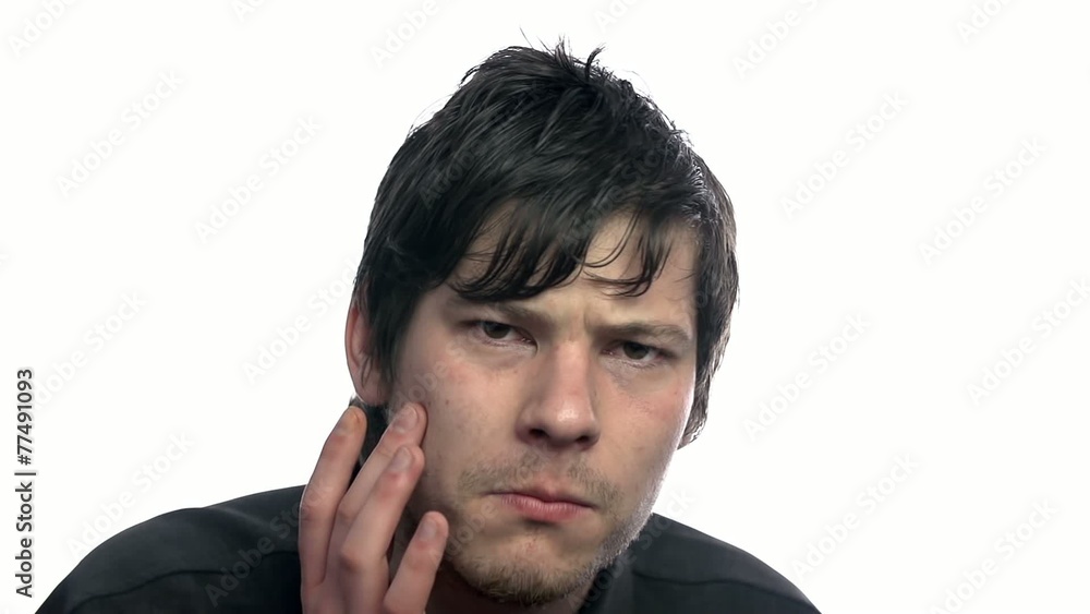 Male having problem with acne Male having problem with acne