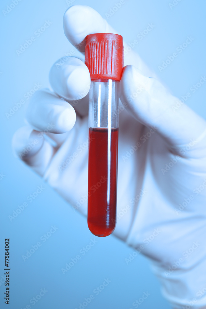 Hand holding blood in test tube take with blue filter Hand holding blood in test tube take with blue filter