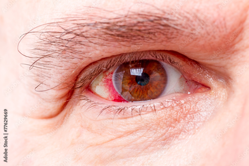 Obraz premium Red human eye