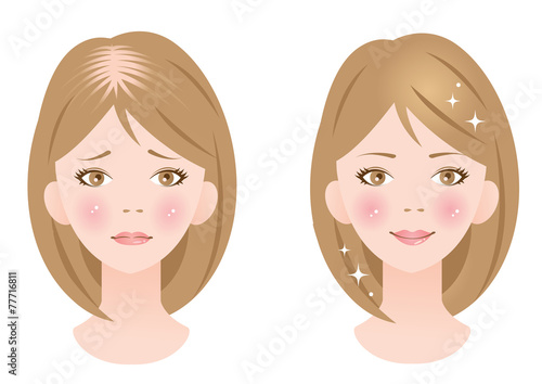ヘアケア