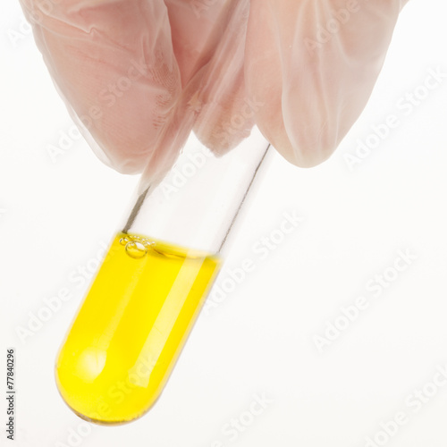 Yellow Liquid in Test Tube